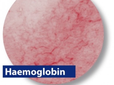 Haemoglobin-UK copy.jpg