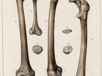 Femur and patella of an adult and an infant.jpg